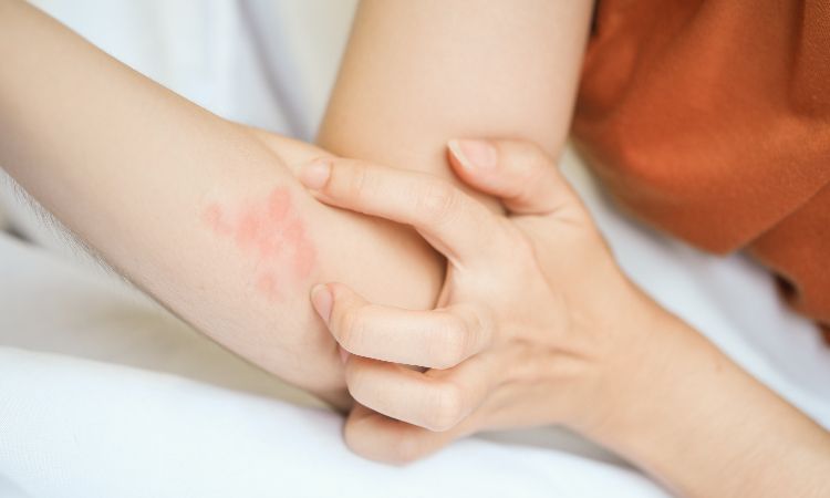 AZS - objawy atopowego zapalenia skóry i sposoby pielęgnacji
