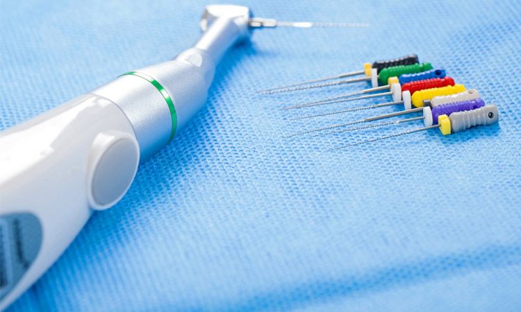 Leczenie endodontyczne zębów – kiedy jest konieczne i na czym polega?