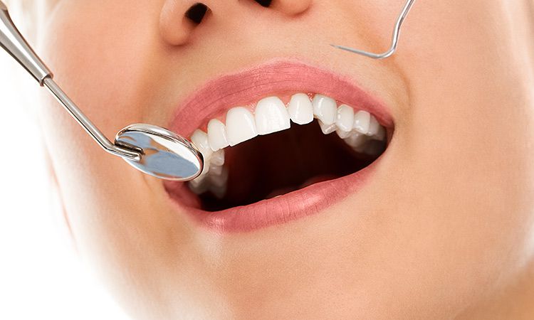 Leczenie próchnicy u dorosłych: remineralizacja szkliwa, plombowanie zębów, leczenie endodontyczne