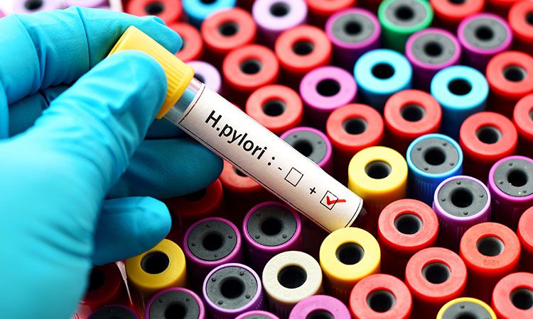 Bakteria Helicobacter pylori. Czym jest i jakie choroby wywołuje?