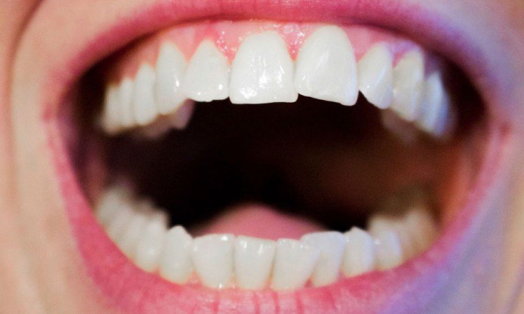 Nić dentystyczna a higiena przestrzeni międzyzębowych
